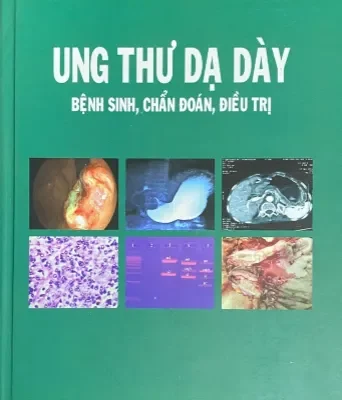 Ung Thư Dạ Dày – Bệnh Sinh, Chẩn Đoán, Điều Trị (Bìa Cứng) – Trần Thiện Trung